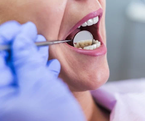 wizyta u dentysty